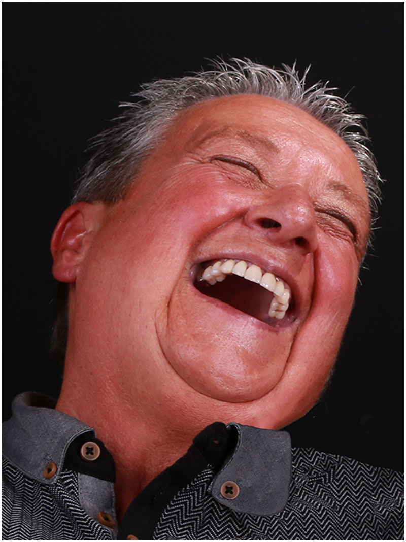 What a laugh !